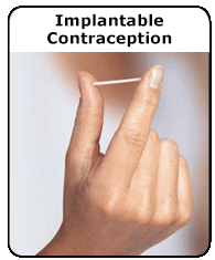 The Green Journal on X: Referral Center Experience With Nonpalpable  Contraceptive Implant Removals. Most nonpalpable contraceptive implants can  be removed in the office by an experienced subspecialty health care  provider after ultrasound