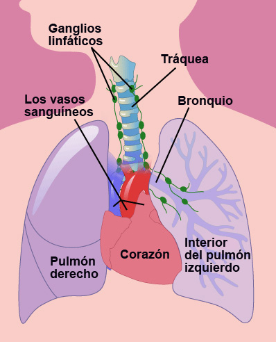 tomografia pulmonar com contraste