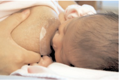 Nipple Shields and Breastfeeding